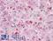 SET Nuclear Proto-Oncogene antibody, LS-B4032, Lifespan Biosciences, Immunohistochemistry frozen image 