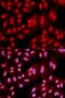 Protein Phosphatase 2 Regulatory Subunit Balpha antibody, orb136126, Biorbyt, Immunocytochemistry image 