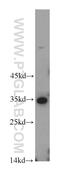 Partner Of NOB1 Homolog antibody, 21059-1-AP, Proteintech Group, Western Blot image 