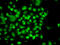 SET And MYND Domain Containing 3 antibody, 22-853, ProSci, Immunofluorescence image 