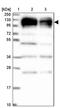 5'-3' Exoribonuclease 2 antibody, PA5-61433, Invitrogen Antibodies, Western Blot image 