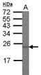 Eukaryotic Translation Initiation Factor 3 Subunit A antibody, PA5-31296, Invitrogen Antibodies, Western Blot image 