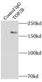 DNA Topoisomerase II Beta antibody, FNab08869, FineTest, Immunoprecipitation image 