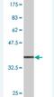 Putative Homeodomain Transcription Factor 1 antibody, H00010745-M01, Novus Biologicals, Western Blot image 