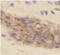 Interleukin 19 antibody, FNab04234, FineTest, Immunohistochemistry paraffin image 