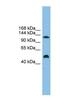 Phosphoribosylglycinamide Formyltransferase, Phosphoribosylglycinamide Synthetase, Phosphoribosylaminoimidazole Synthetase antibody, NBP1-57774, Novus Biologicals, Western Blot image 