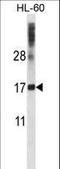 Dynein Axonemal Light Chain 4 antibody, LS-C167482, Lifespan Biosciences, Western Blot image 