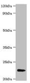 Fibroblast Growth Factor 21 antibody, LS-C316809, Lifespan Biosciences, Western Blot image 