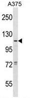 Taste 1 Receptor Member 1 antibody, AP54153PU-N, Origene, Western Blot image 