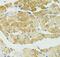 RALBP1 antibody, FNab07095, FineTest, Immunohistochemistry paraffin image 