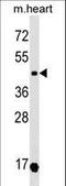 Oxytocin Receptor antibody, LS-C158516, Lifespan Biosciences, Western Blot image 