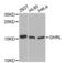 Ghrelin And Obestatin Prepropeptide antibody, LS-C335148, Lifespan Biosciences, Western Blot image 