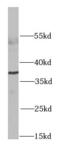 Ribosomal Protein Lateral Stalk Subunit P0 antibody, FNab07447, FineTest, Western Blot image 