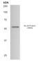 Interleukin 20 Receptor Subunit Alpha antibody, GTX52848, GeneTex, Western Blot image 