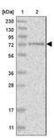 Serine/Threonine Kinase Like Domain Containing 1 antibody, NBP1-82686, Novus Biologicals, Western Blot image 