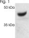 Proteasome 26S Subunit, ATPase 2 antibody, NB120-3322, Novus Biologicals, Western Blot image 