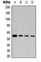 Tubulin Beta 1 Class VI antibody, abx121803, Abbexa, Western Blot image 