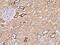 Pleckstrin Homology And FYVE Domain Containing 2 antibody, 209034-T08, Sino Biological, Immunohistochemistry paraffin image 