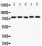 Tyrosine-protein kinase Tec antibody, PA2000, Boster Biological Technology, Western Blot image 