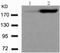 Eukaryotic Translation Initiation Factor 4 Gamma 1 antibody, TA322698, Origene, Western Blot image 