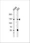 Sirtuin 1 antibody, M00018-1, Boster Biological Technology, Western Blot image 