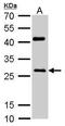 NAD(P)H Quinone Dehydrogenase 1 antibody, GTX100235, GeneTex, Western Blot image 