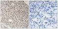 Angiomotin Like 1 antibody, abx014190, Abbexa, Western Blot image 