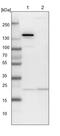 ADP Ribosylation Factor Like GTPase 3 antibody, PA5-57599, Invitrogen Antibodies, Western Blot image 