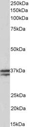 sTnT antibody, 43-214, ProSci, Western Blot image 