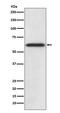 Catalase antibody, M03123, Boster Biological Technology, Western Blot image 