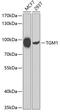 Transglutaminase 1 antibody, GTX32921, GeneTex, Western Blot image 