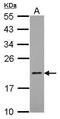 Mitochondrial Ribosomal Protein L21 antibody, PA5-31939, Invitrogen Antibodies, Western Blot image 