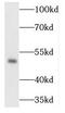 Transcriptional Adaptor 3 antibody, FNab08476, FineTest, Western Blot image 