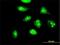 NOP16 Nucleolar Protein antibody, H00051491-B01P, Novus Biologicals, Immunofluorescence image 