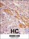 Phosphoglycerate Kinase 1 antibody, 62-700, ProSci, Immunohistochemistry paraffin image 