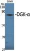 Diacylglycerol Kinase Alpha antibody, A06354, Boster Biological Technology, Western Blot image 