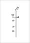 Suppression Of Tumorigenicity 7 Like antibody, PA5-35289, Invitrogen Antibodies, Western Blot image 