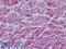 Myogenic Factor 5 antibody, LS-B9137, Lifespan Biosciences, Immunohistochemistry paraffin image 