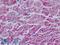 Myogenic factor 5 antibody, LS-B9137, Lifespan Biosciences, Immunohistochemistry paraffin image 