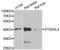 ST3 Beta-Galactoside Alpha-2,3-Sialyltransferase 4 antibody, A05863, Boster Biological Technology, Western Blot image 