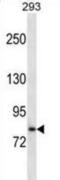 Solute Carrier Family 39 Member 6 antibody, abx028750, Abbexa, Western Blot image 