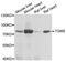 Transglutaminase 5 antibody, STJ29119, St John