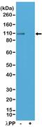 Glutamate Ionotropic Receptor AMPA Type Subunit 1 antibody, MA5-27975, Invitrogen Antibodies, Western Blot image 