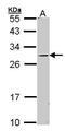 Steroidogenic Acute Regulatory Protein antibody, PA5-21687, Invitrogen Antibodies, Western Blot image 