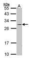 Steroidogenic Acute Regulatory Protein antibody, PA5-21687, Invitrogen Antibodies, Western Blot image 