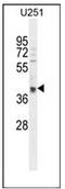 OTU Deubiquitinase 3 antibody, AP53132PU-N, Origene, Western Blot image 