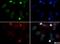 RAD51 Paralog D antibody, NB100-178, Novus Biologicals, Immunofluorescence image 