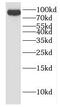 DEAH-Box Helicase 15 antibody, FNab02375, FineTest, Western Blot image 