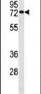 Cell Division Cycle 25B antibody, PA5-14102, Invitrogen Antibodies, Western Blot image 