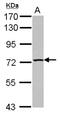 TBC1 Domain Family Member 15 antibody, NBP2-20577, Novus Biologicals, Western Blot image 